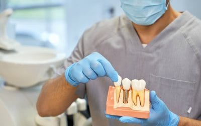 Choosing the right dentist for your implants