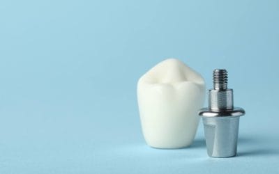 My dental implant treatment – a patient shares his story