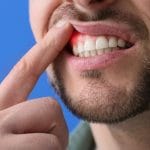 man holding lip up showing gum disease