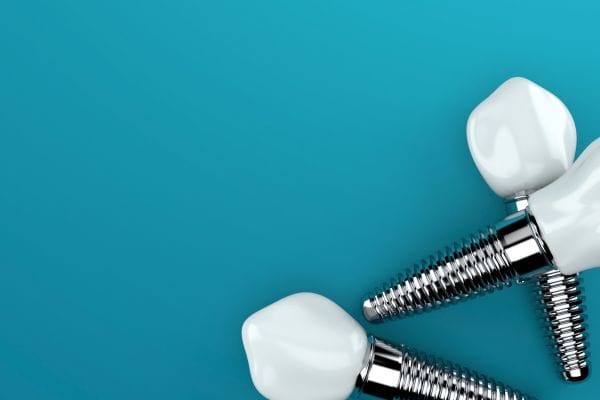 Graphic of three dental implants on a teal background