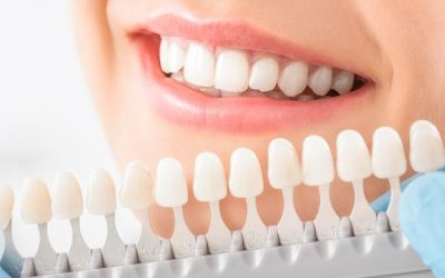 Your Guide to Professional Teeth Whitening Treatment in 2026