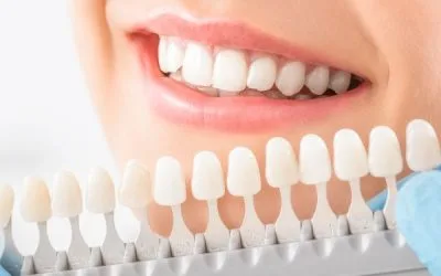 Your Guide to Professional Teeth Whitening Treatment in 2026
